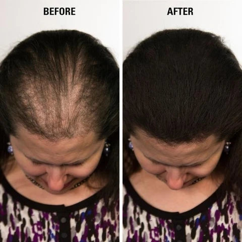 Veloura™ Premium Hair Fibres