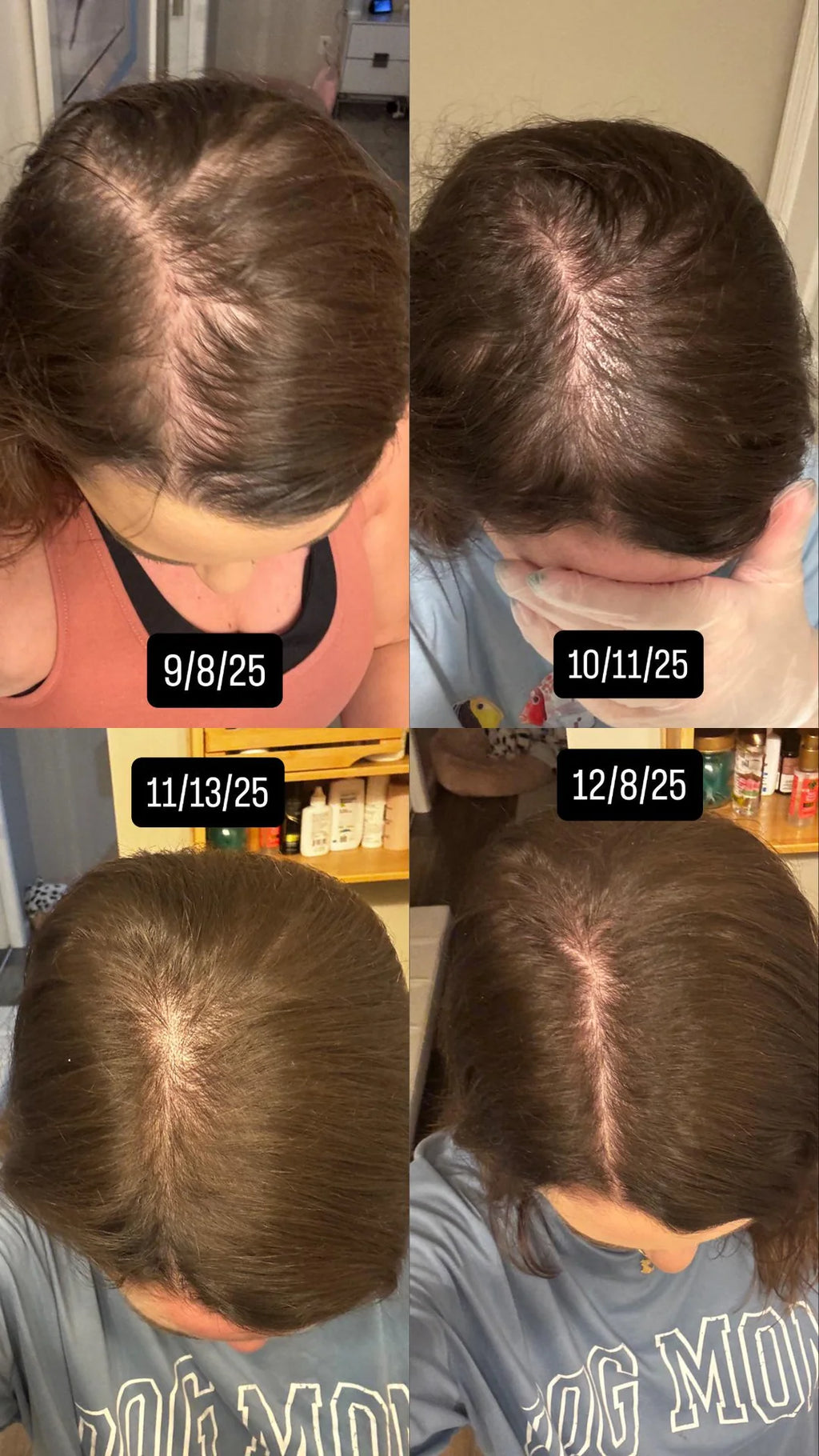 Veloura™ 5% Minoxidil Hair Growth Serum