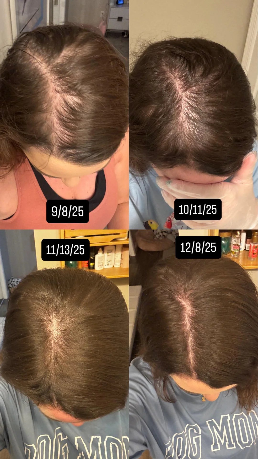 Veloura™ 5% Minoxidil Hair Growth Serum