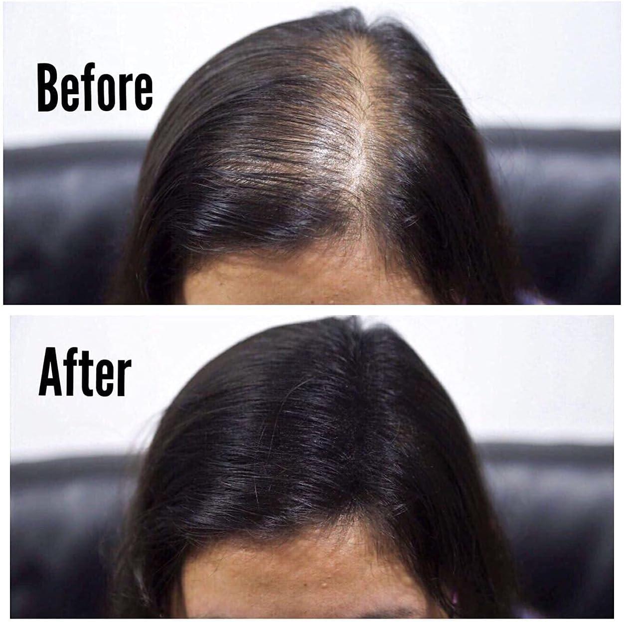 Veloura™ Premium Hair Fibres