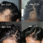 Veloura™ Rosemary Hair Growth