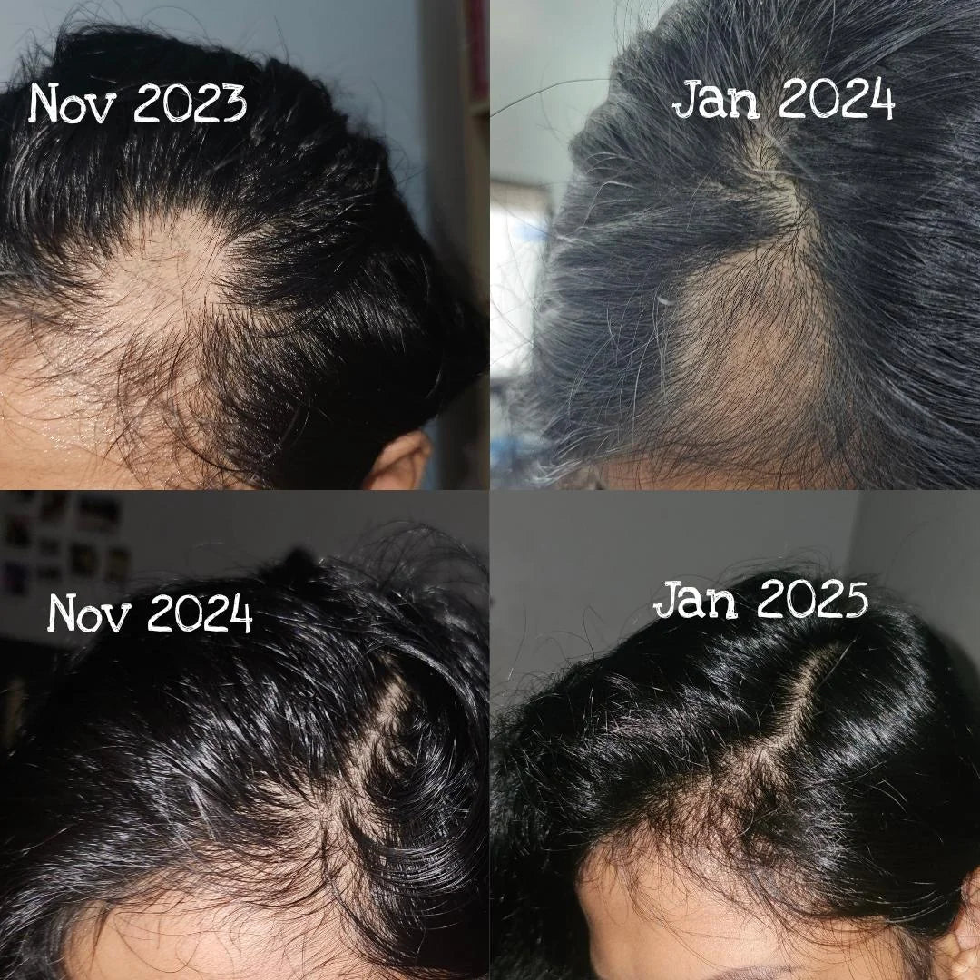 Veloura™ Rosemary Hair Growth