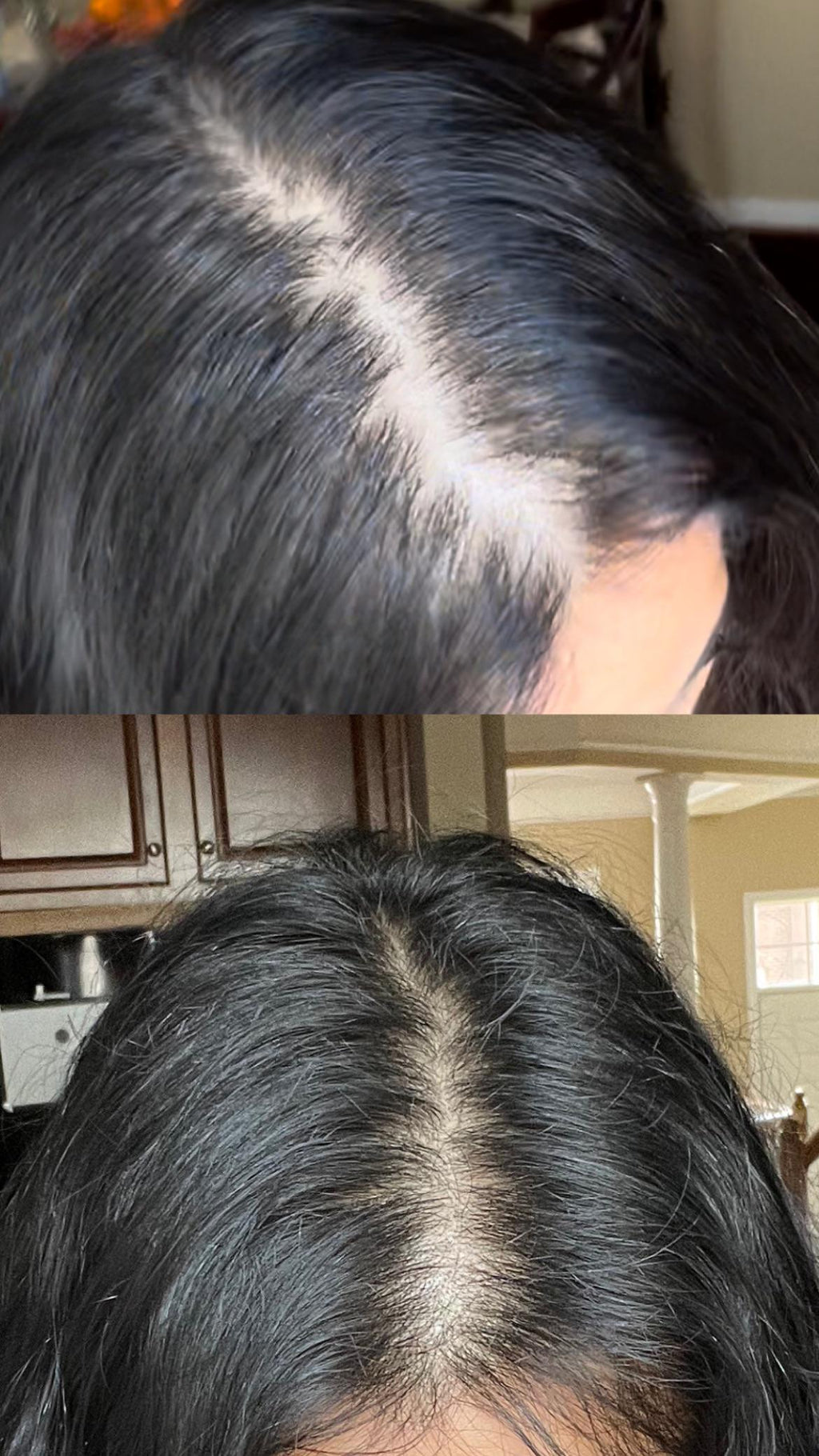 Veloura™ Rosemary Hair Growth