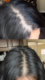 Veloura™ Rosemary Hair Growth