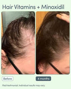 Veloura™ 5% Minoxidil Hair Growth Serum