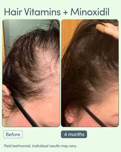 Veloura™ 5% Minoxidil Hair Growth Serum